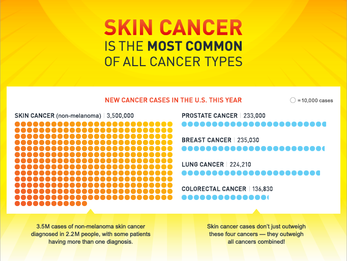 Skin Cancer Picture Chart